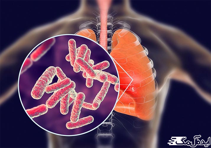 راهنمای نمونه گیری آزمایش IGRA