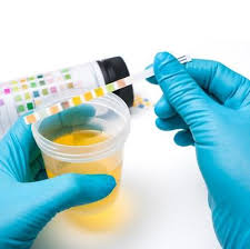 جمع آوری ادرار برای آزمایش کشت و ادرار کامل